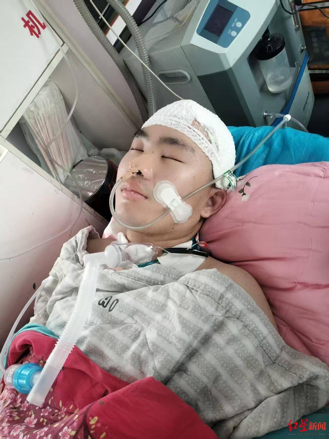 “23歲研究生被少年無證駕車撞致顱腦損傷”追蹤：當地政府為其申辦困難補助，愛心網友捐款相助