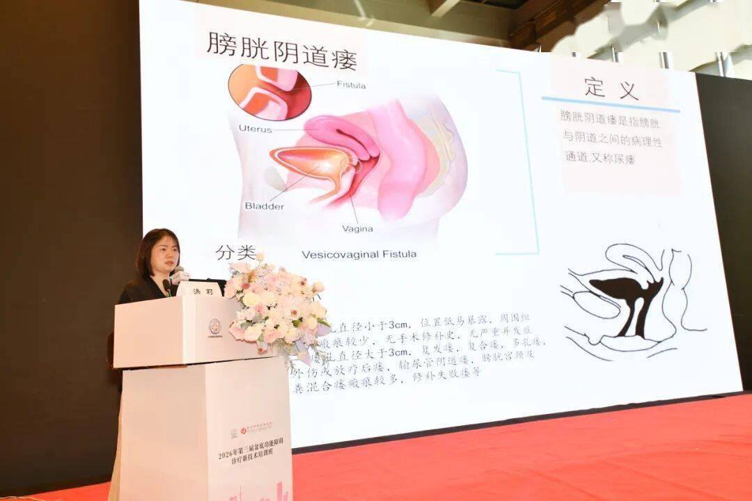 新聞集錦丨聚力盆底診療前沿，共築女性健康防線