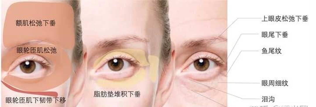 美容儀，是智商稅還是黑科技？